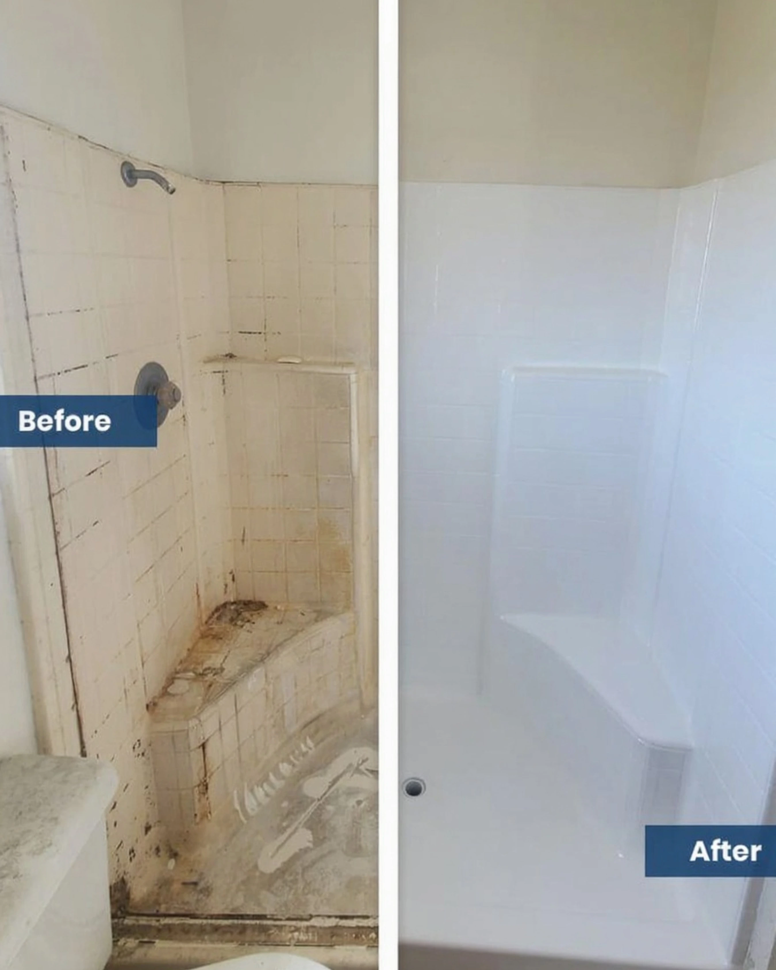 Enamel repair Anaheim CA